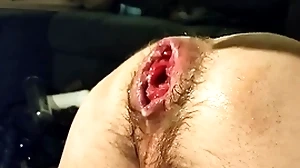 Unique fisting my rejected crack added to prolapse:)