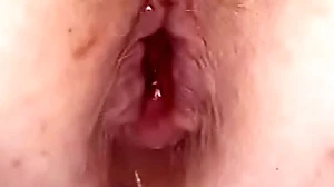 Anal scarper near my arse