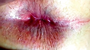 Botheration with the addition of anus closeup